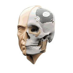 Métier : Logiciels 3D numériques pour le Maxillo Facial - KALLISTO